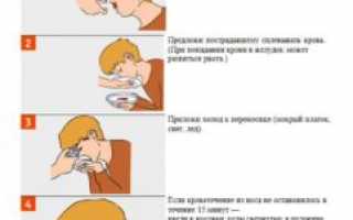 Причины появления крови в носу у детей