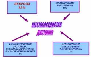 Какие препараты можно использовать для лечения ВСД