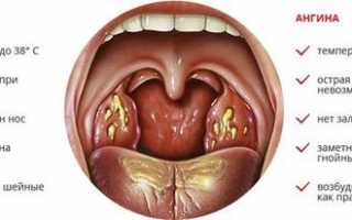 Болит горло и поднялась температура — что делать, причины и лечение