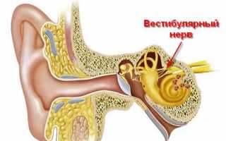 Как связаны болезнь Меньера и головокружение