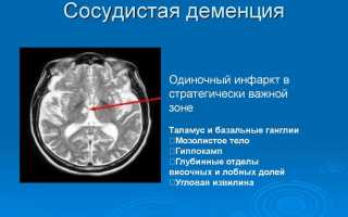 Что такое сосудистая деменция: в чем причина нарушений и можно ли их устранить