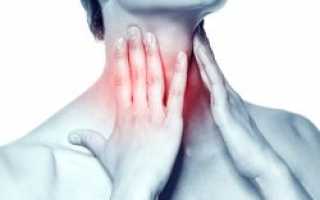 Белый налет в горле — как избавиться от белых точек на стенках глотки
