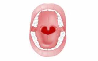 Красная сыпь в горле — что делать при покраснении задней стенки горла