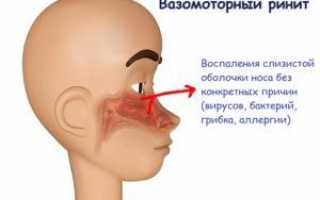 Как понять что у грудничка начался насморк