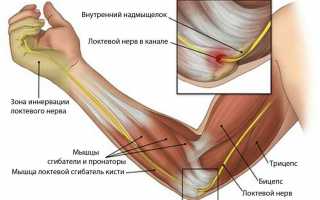 Почему появилось защемление нерва в локтевом суставе и как от него избавиться