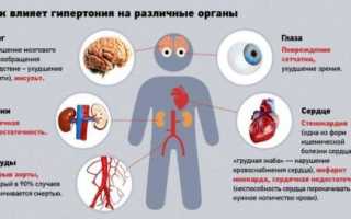 Мучают постоянные головные боли — что это может быть, диагностика