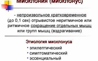 Что такое миоклонус: нужно ли лечить непроизвольные мышечные сокращения