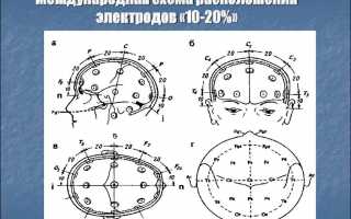 В каких случаях может быть назначена энцефалограмма головного мозга: показания и описание метода диагностики