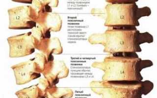 Сакрализация l5 позвонка