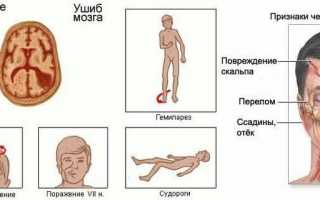 Какие таблетки могут быть назначены при сотрясении головного мозга: список препаратов