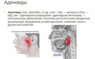 Четыре степени аденоидов у детей