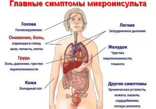 микроинсульт - симптомы