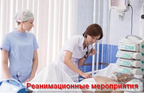 реанимационные мероприятия