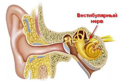 болезнь Меньера - причины