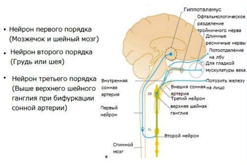 Патогенез развития синдрома Горнера