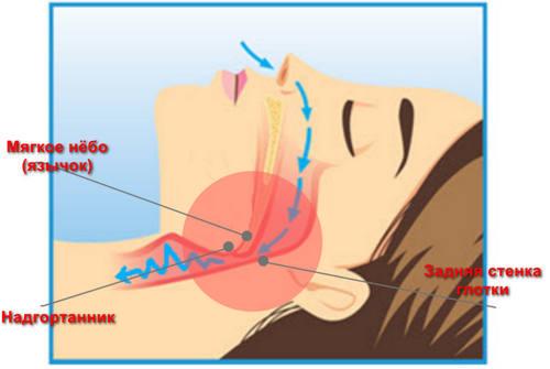 Патогенез развития апноэ сна