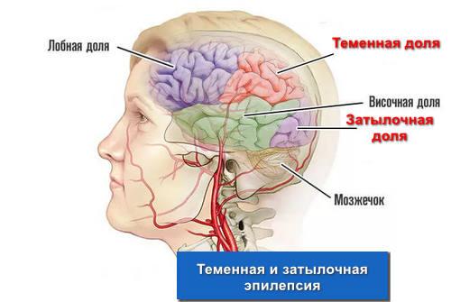 Теменная и затылочная эпилепсия