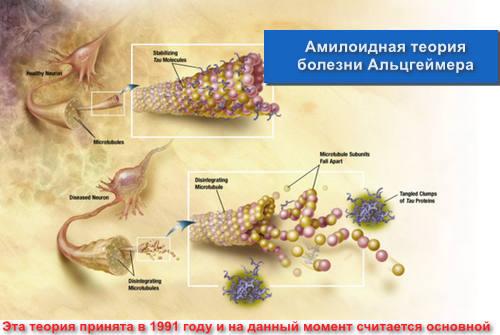 Амилоидная теория болезни Альцгеймера