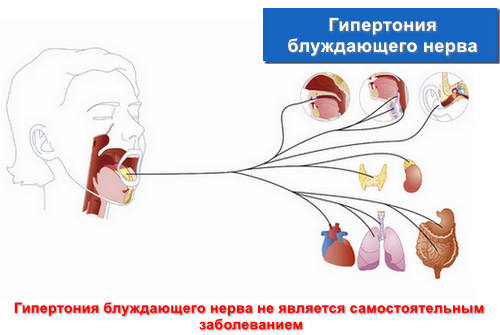 Гипертония блуждающего нерва