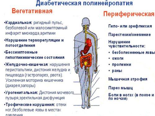 Диабетическая форма