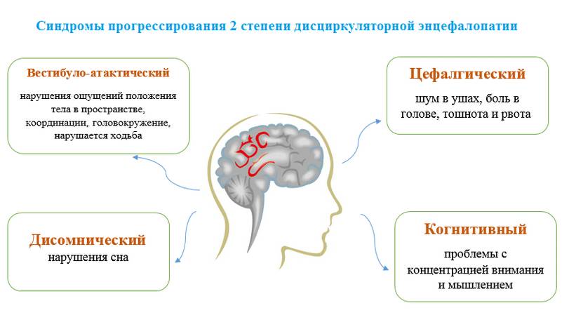 Дисциркуляторная энцефалопатия 2 степень