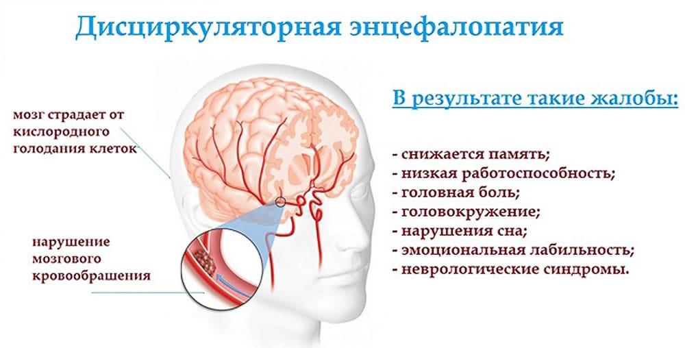 Дисциркуляторная энцефалопатия причины