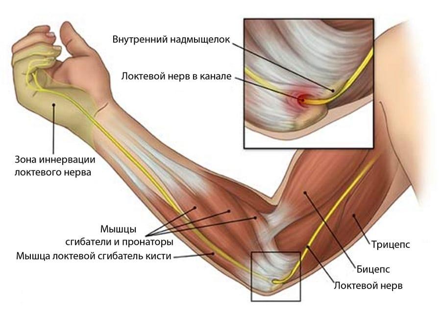 Локтевой нерв в канале