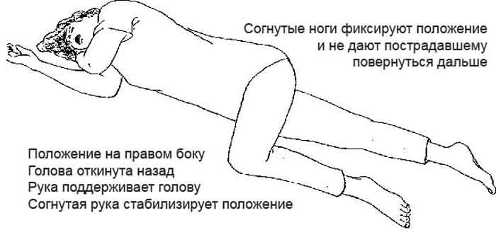 Первая помощь при сотрясении мозга