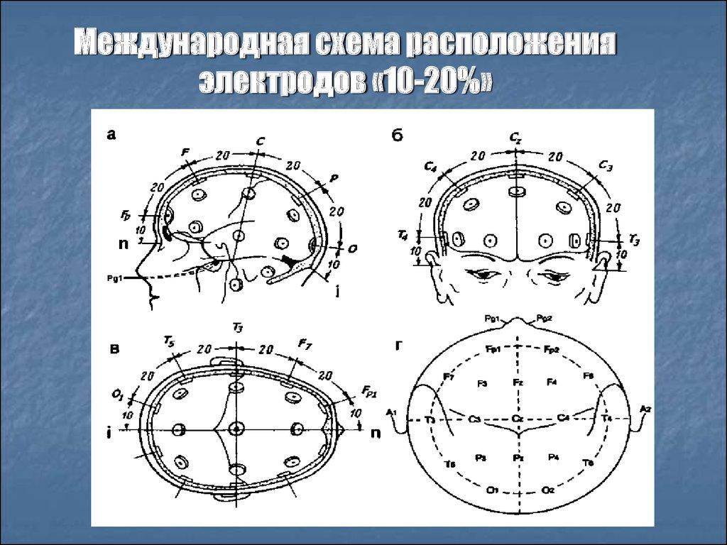 Схема расположения электродов
