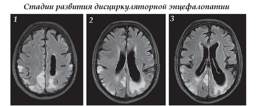 Стадии развития