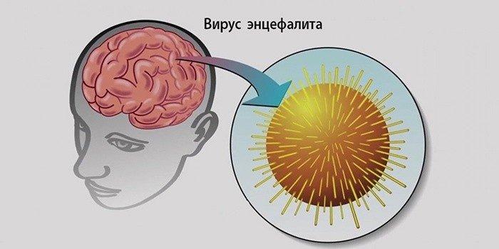 Вирус энцефалита