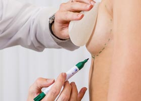 Увеличение груди с помощью имплантов в топ-клинике Этианум, Гейдельберг, Германия